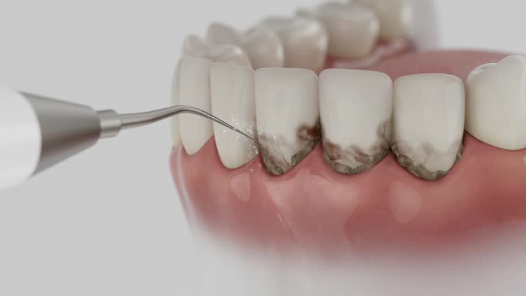 Trusted Dental Crowns And Bridges service in Branford Center, CT - Dentist Open Now